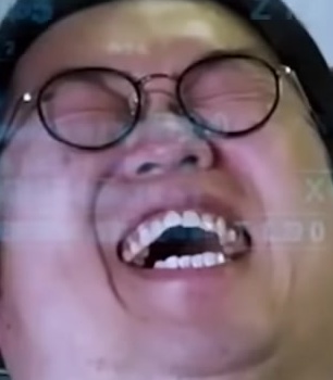 Face