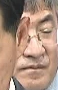 Face