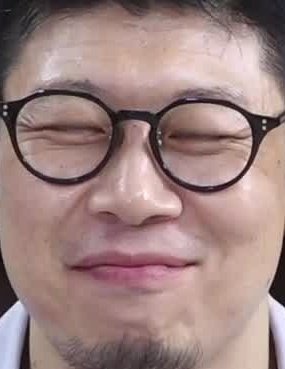 Face