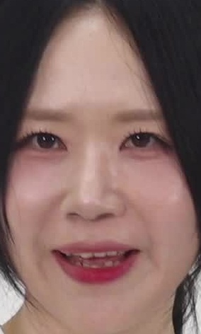 Face