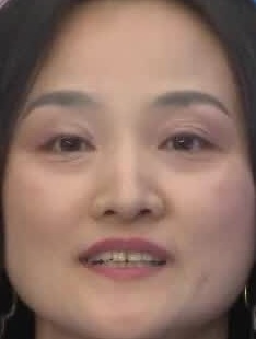 Face