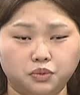 Face