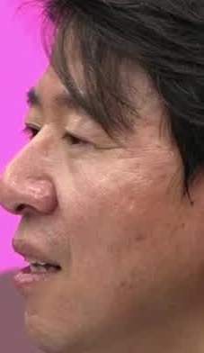 Face