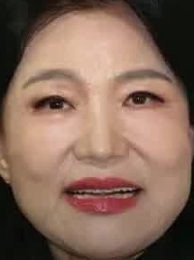 Face