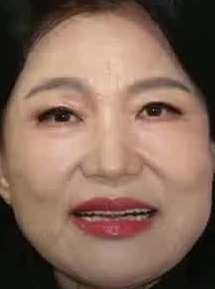 Face