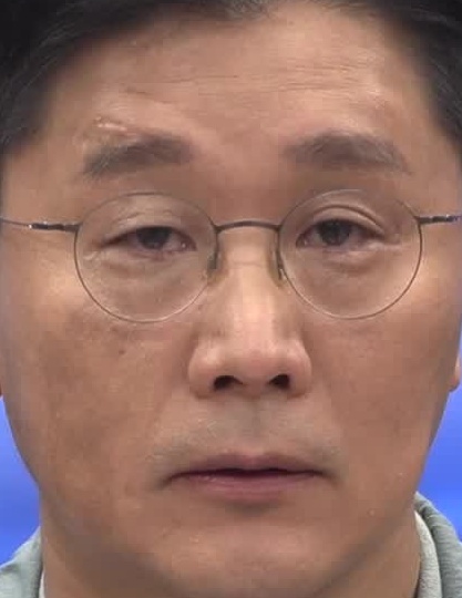 Face
