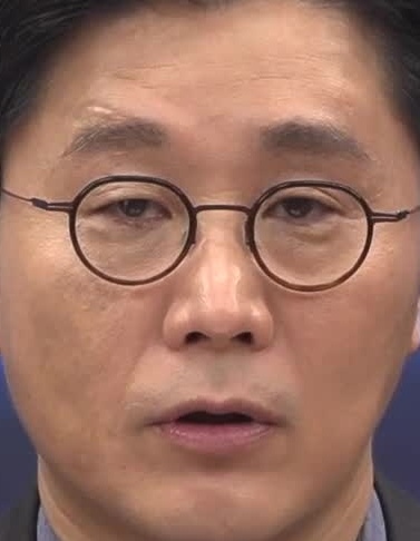 Face