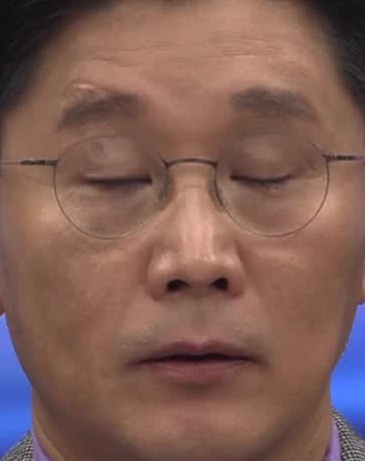 Face
