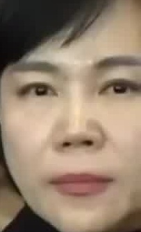 Face
