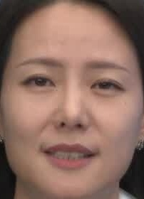 Face