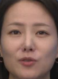 Face