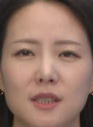 Face
