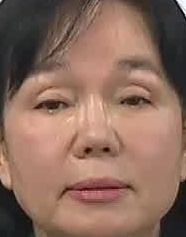 Face