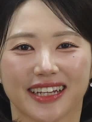 Face