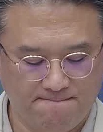 Face