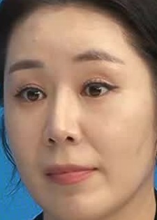 Face