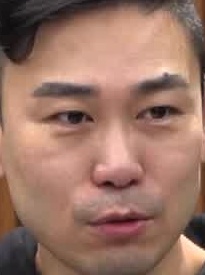 Face